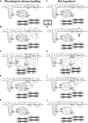 Calcium in Brugada Syndrome: Questions for Future Research